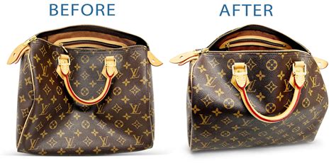 lv speedy 30 bag shaper
